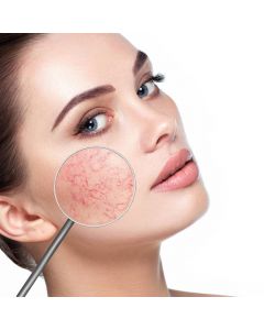 Workshop Huidoneffenheden verwijderen met Diathermie