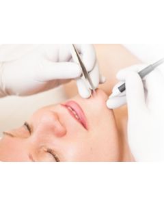 Ontharingstechnieken Elektrische Ontharen, diathermie en blendmethode