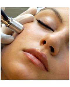 Microdermabrasie met of zonder ADAP registratie