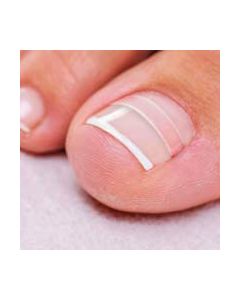 Medisch Pedicure: Cursus Nagelbeugels (9 accreditatiepunten) Medisch Pedicure: Cursus Nagelbeugels (9 accreditatiepunten)