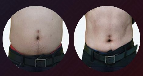 resultaten bowie EMS