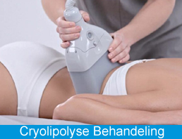 Cryolipolyse Behandeling Cryolipolyse Behandeling