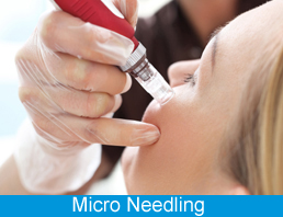 Micro Needling Micro Needling