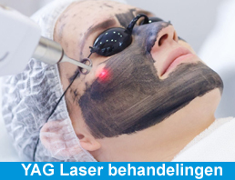 YAG laser behandelingen YAG laser behandelingen